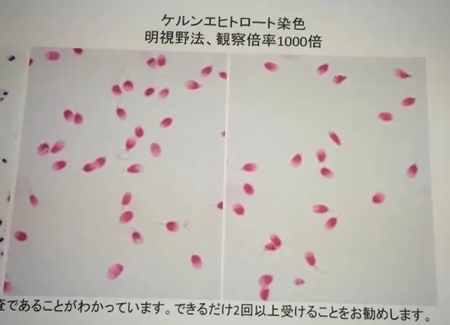 Man in Suzuka offered 9 million yen for his semen, conned out of 38 million yen