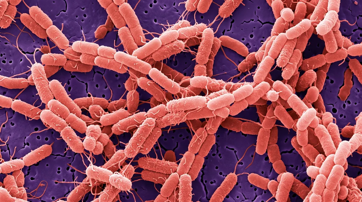 Nuevo brote de Salmonella en EE. UU.: la FDA investiga 84 casos sin identificar aún el alimento responsable