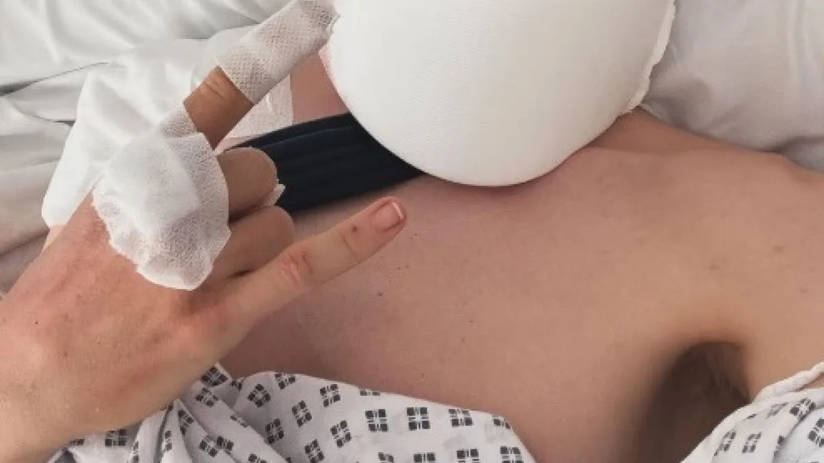 Cuándo podrá volver a competir Pogacar tras su aparatosa caída en La Vuelta: pasará por quirófano y tendrá que dejar el ciclismo por un tiempo