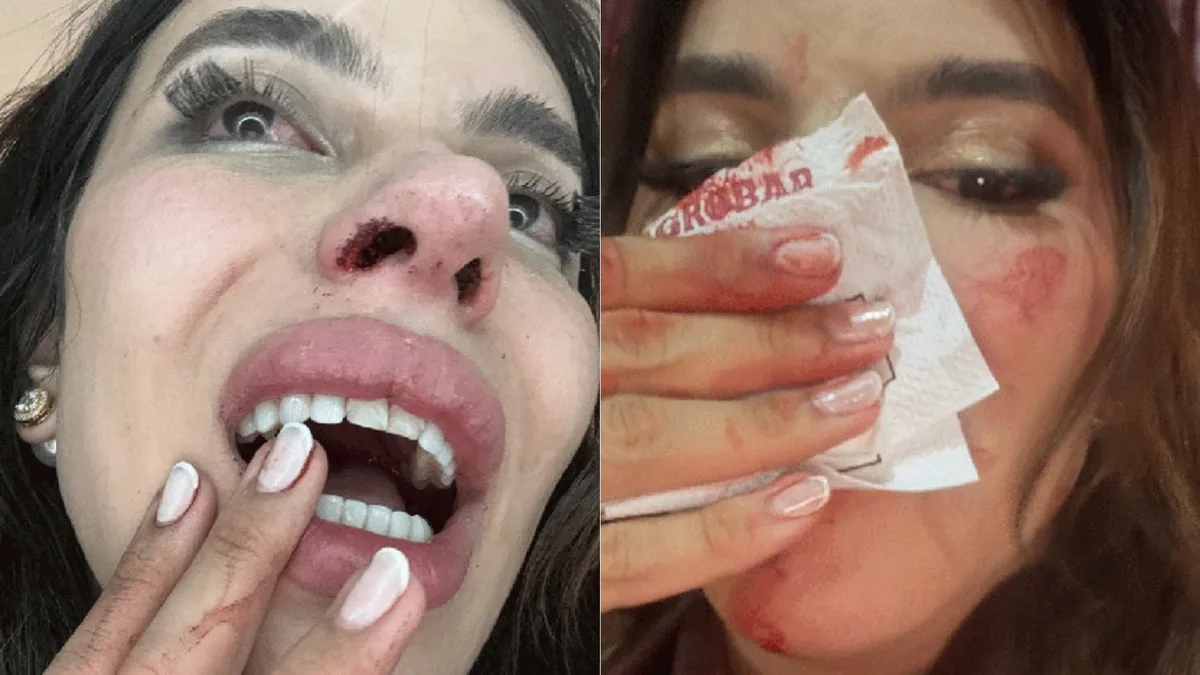 Influenciadora denuncia agressão por transfobia em bar no MA; polícia investiga motivação