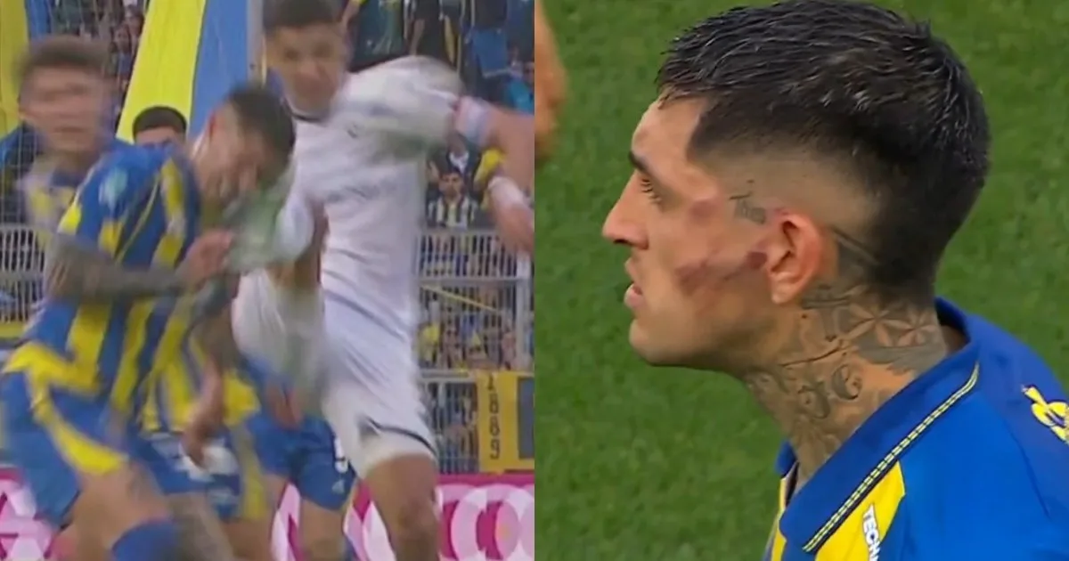 Tras la patada de Álex Arce, Gastón Ávila debió ser trasladado a un sanatorio: el comunicado de Rosario Central