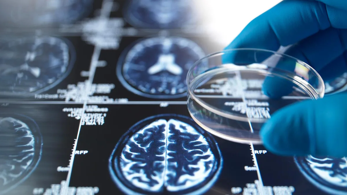 3D-Hirngewebemodell soll Alzheimer-Forschung verbessern