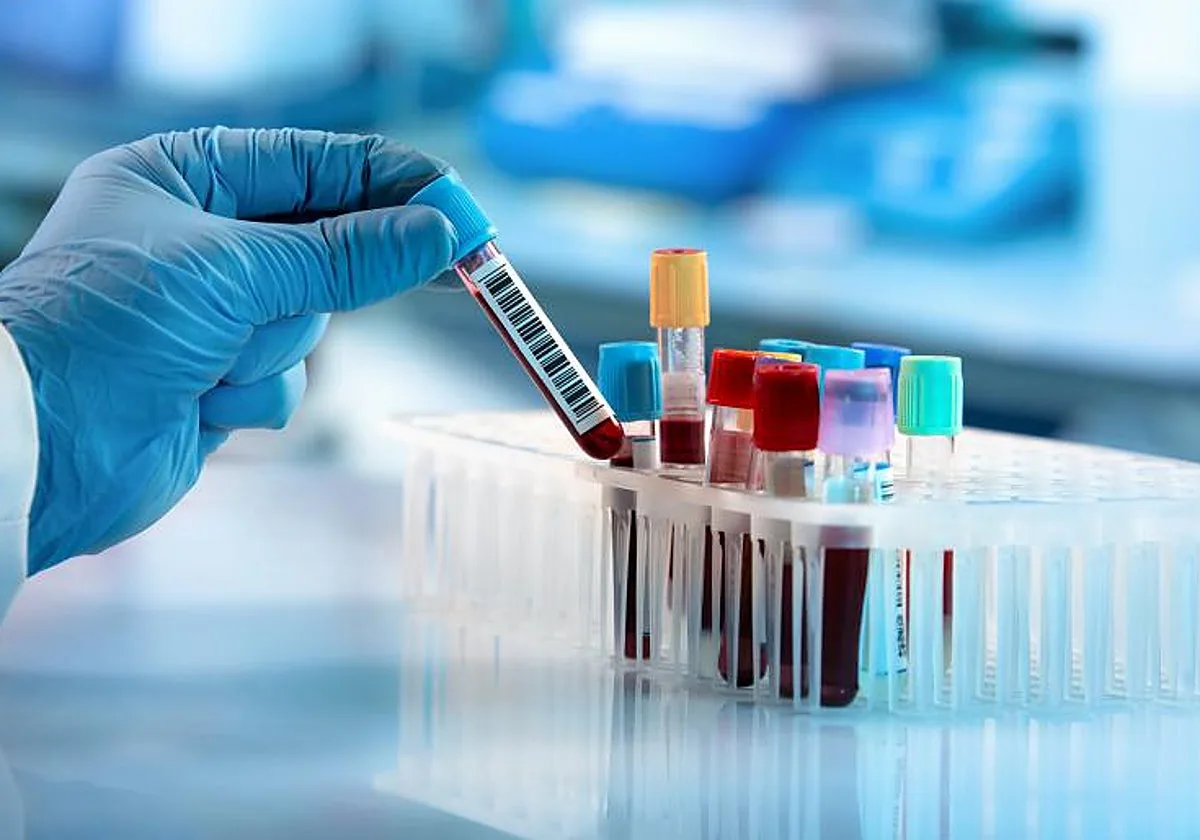 Un análisis de sangre común puede dar la pista sobre el riesgo de demencia futura