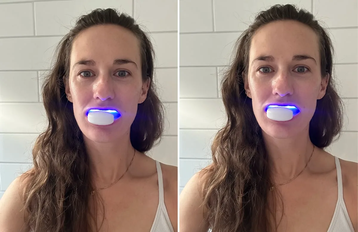 This LED teeth whitening kit gave me a brighter smile in less than 7 days