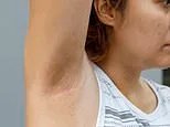 Mysterious brown marks have appeared under my armpits and breasts. I'm an otherwise healthy woman but I'm worried. DR SCURR reveals how to tell a common bacterial infection from something MUCH more sinister