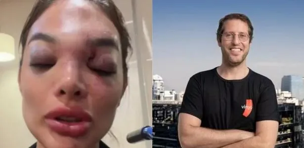 Empresário ofereceu Pix para 'sumirem' com dentista após agressão, diz pai