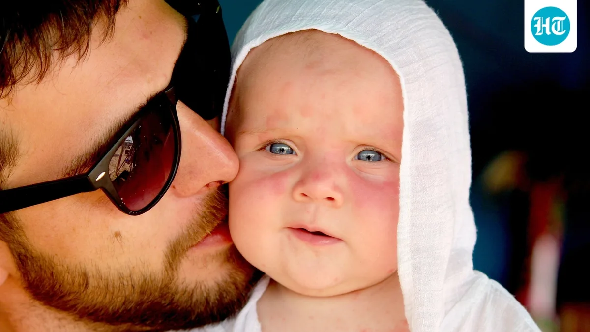Can adults get measles too? Doctors explain symptoms, risk, and the importance of vaccinations