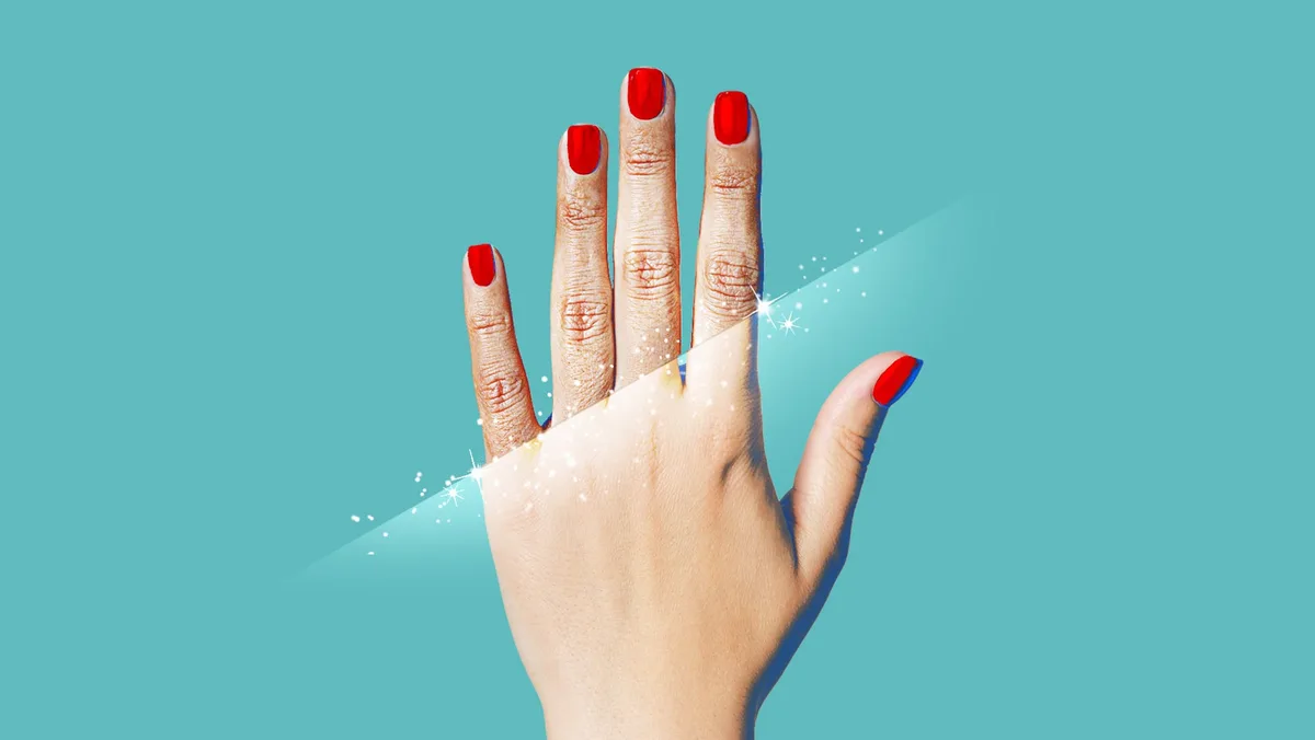 Women Turn to 30-Minute Treatment for Younger-Looking Hands