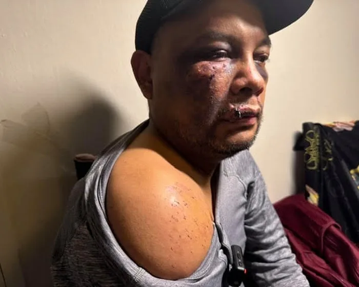 Man suffered brain injury and severe bruising after ICE arrest in Virginia, records show