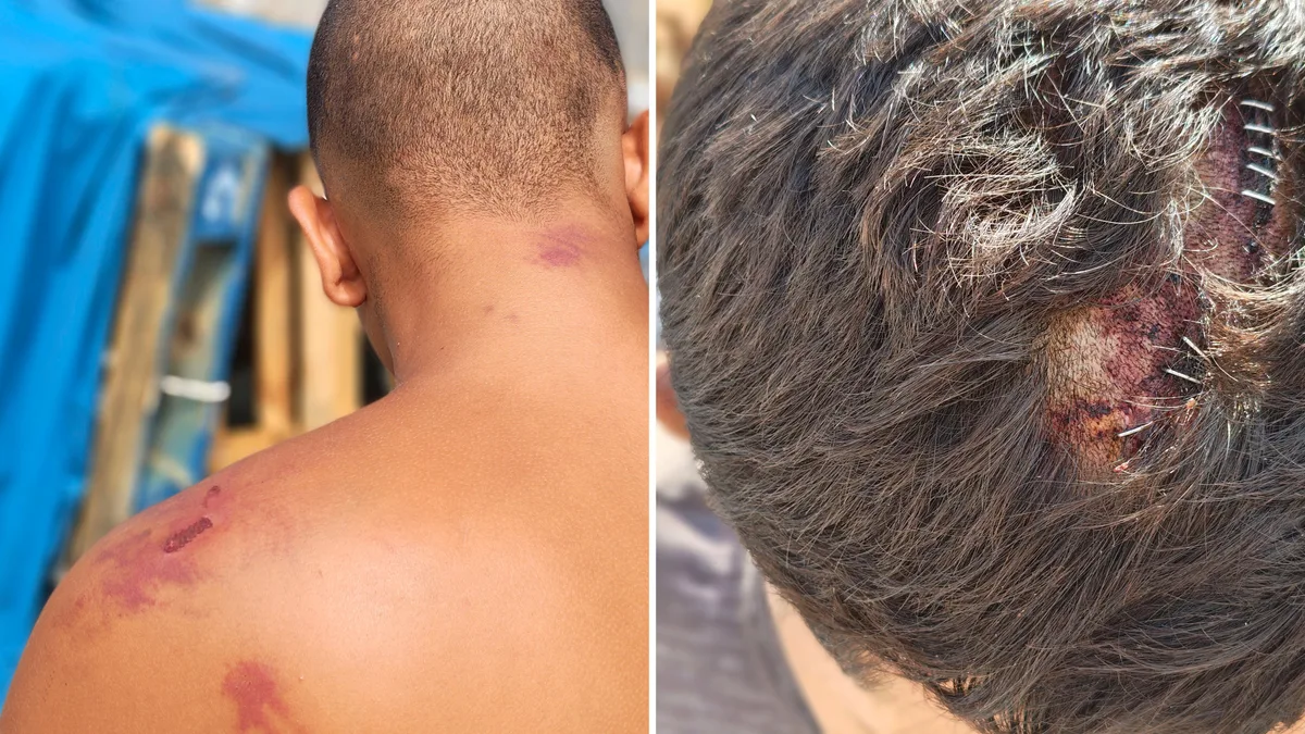 Avances sobre las presuntas agresiones de militares a migrantes en Ceuta: Defensa traslada pruebas a Fiscalía y asociaciones exigen investigar y transparencia
