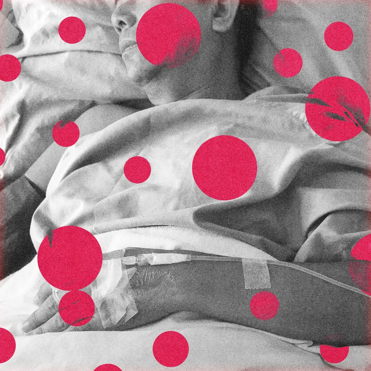 The US Just Recorded Its First 2 Measles Deaths This Year