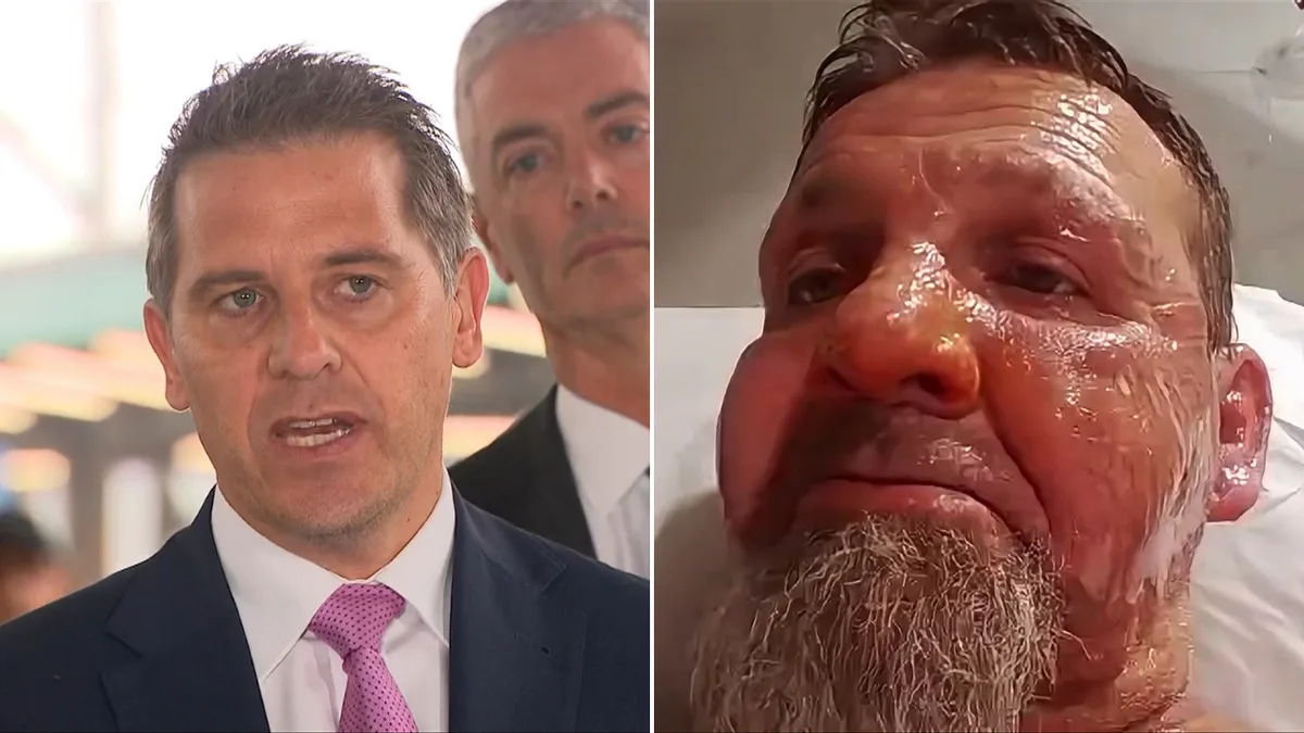 NSW Health Minister Ryan Park calls accused hospital fire bug ‘grub’ after three patients doused in accelerant