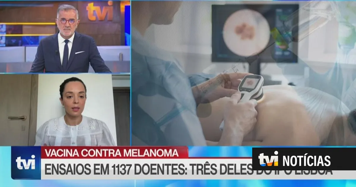 "Muito promissor". Nova vacina contra melanoma "parece ser uma excelente notícia para doentes"