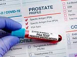 Deadly prostate cancers could be caught sooner after researchers discover telltale genetic 'footprints'