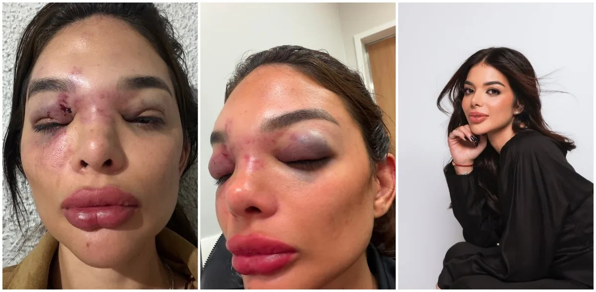 Empresário da Faria Lima é preso por agredir e ameaçar mulher em SP: ' Vi a a morte de perto', diz vítima