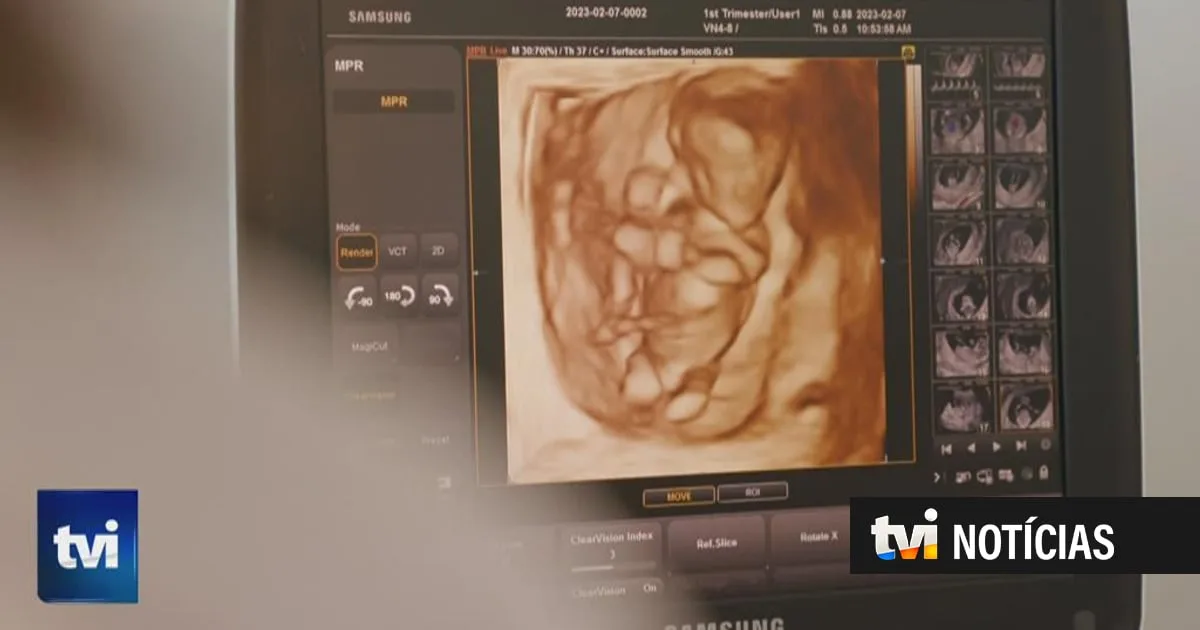 Portugal já regista dois partos por inseminação pós-morte