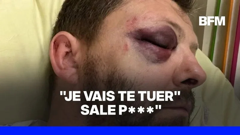 Un policier victime d'une agression homophobe à Paris témoigne