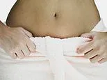 How the way your belly button SMELLS could reveal whether you have a serious disease or infection