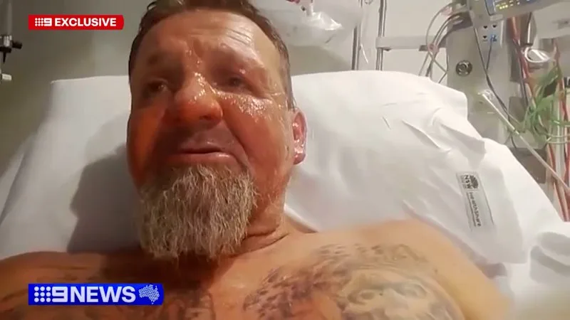 Man set alight at the Prince of Wales hospital