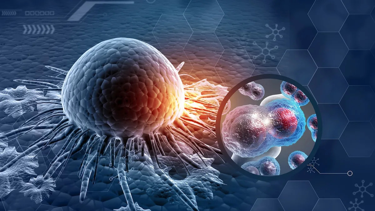 Schwarzer Hautkrebs: „Großer Moment” bei Entwicklung von mRNA-Impfung