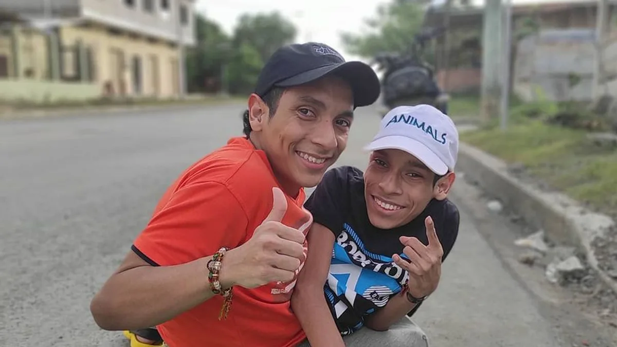Mueren a los 27 años José Luis y José Armando, los hermanos siameses que desafiaron todos los pronósticos