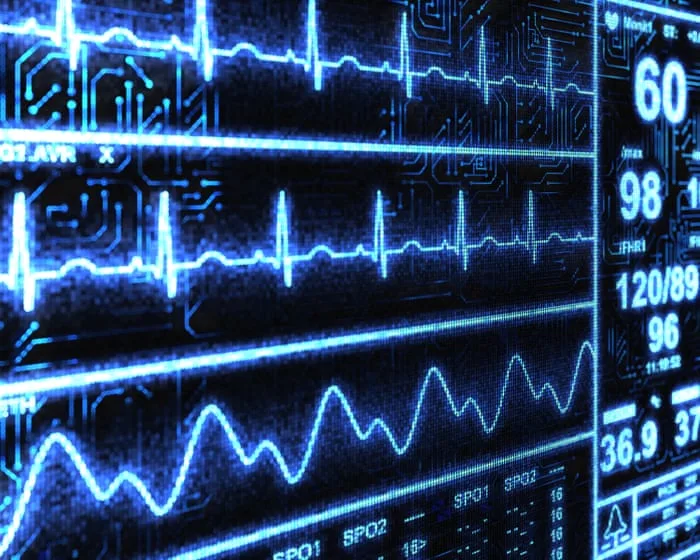 ‘Superhuman’ AI tool spots heart disease in less than 2 seconds