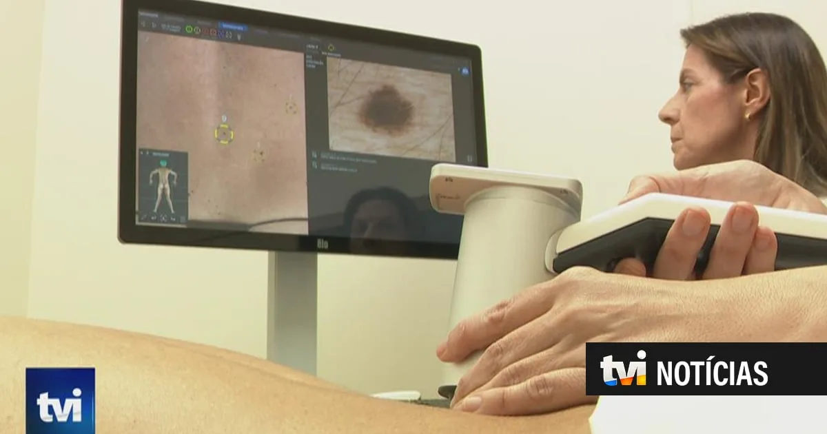 IPO acompanha três doentes que participam no ensaio clínico "revolucionário" para testar vacina contra o melanoma