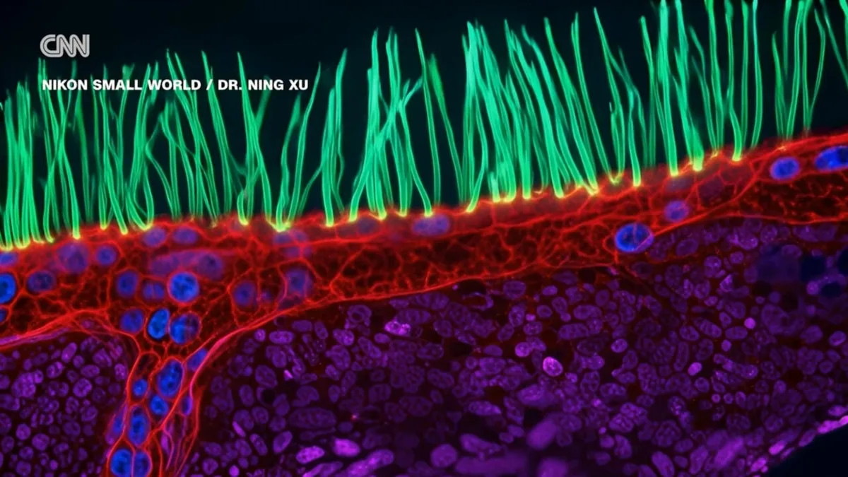 Contest-Winning Microscope Thrown Out for Using Generative AI