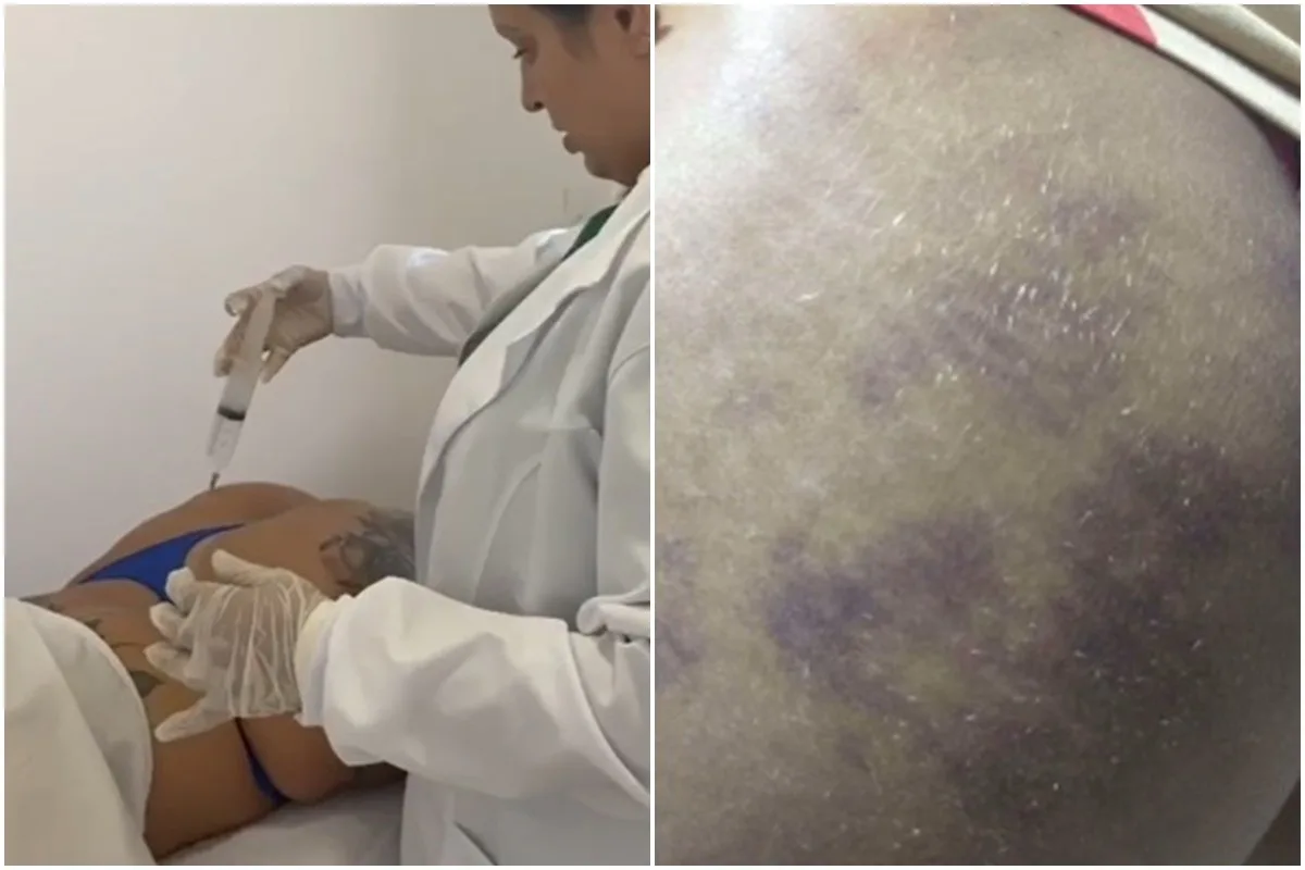 Falsa médica presa em João Pessoa pode responder por pelo menos quatro crimes, afirma delegado