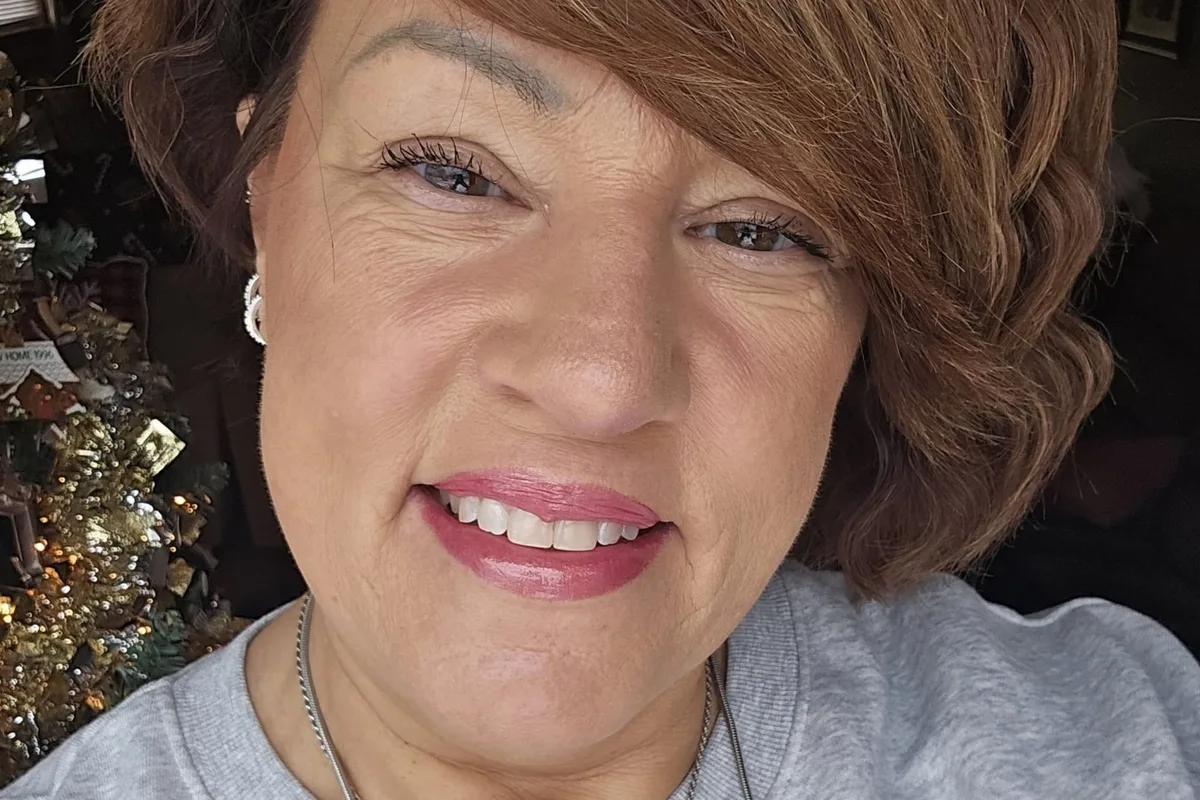 Sharon Lupo, peluquera que advirtió el cáncer de piel en una cliente: “Era casi mancha decolorada”