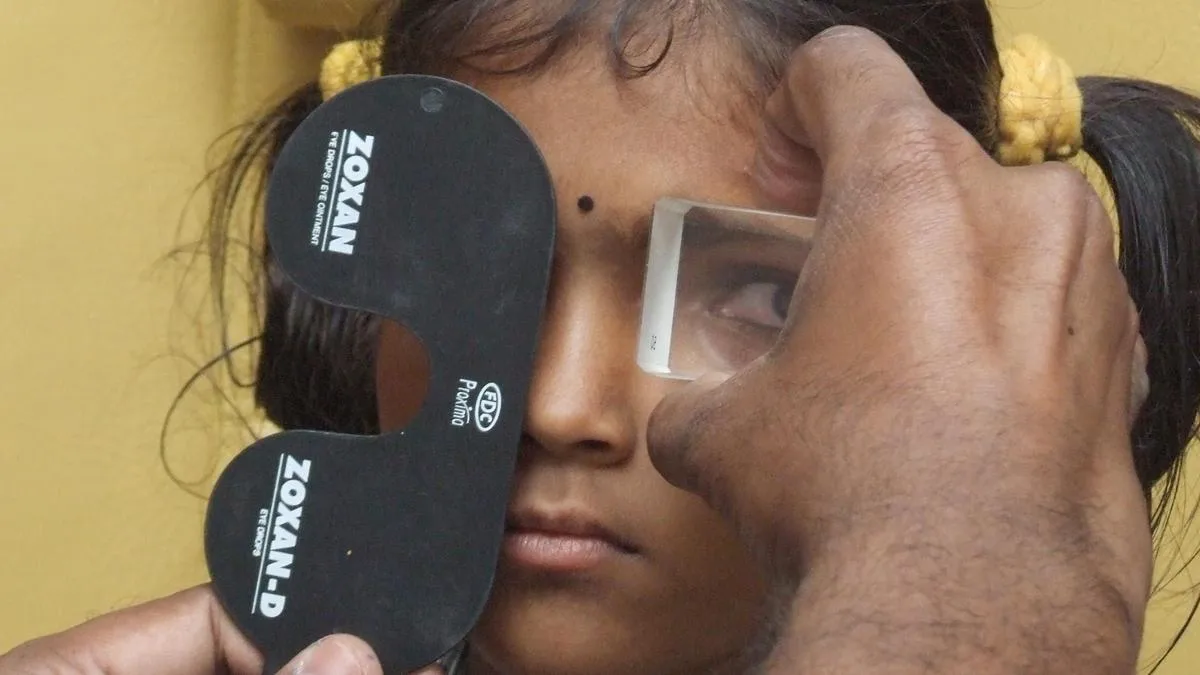 All you need to know about: squint eye