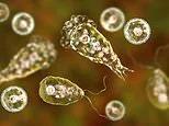 Teen battling rare brain-eating amoeba contracted after swimming in freshwater