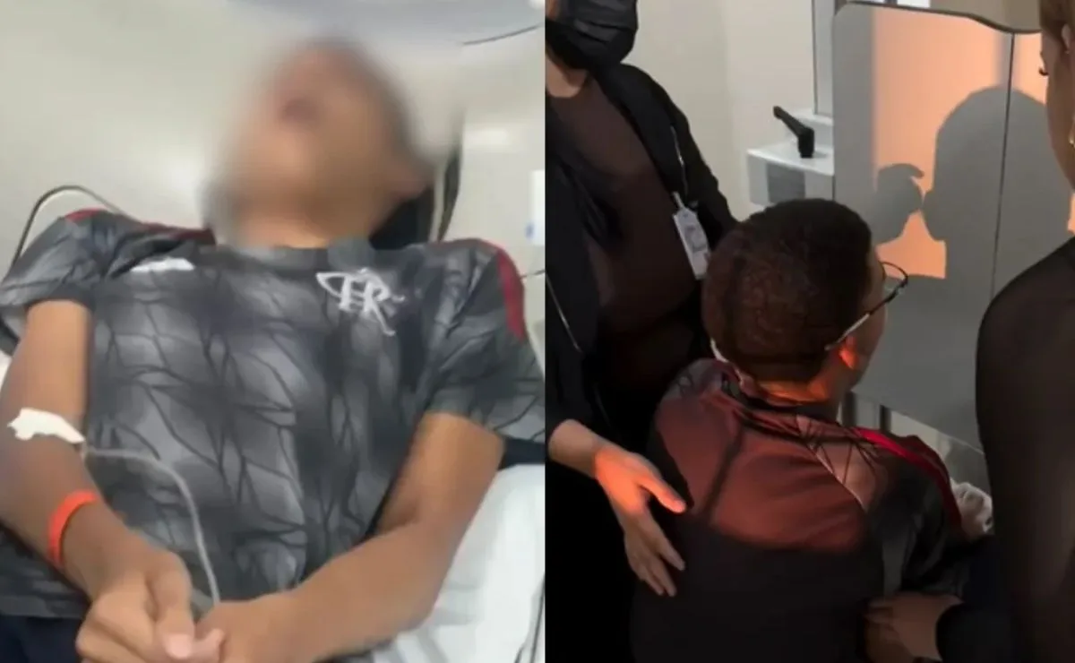 Jovem vai parar na emergência após bocejar e mandíbula sair do lugar