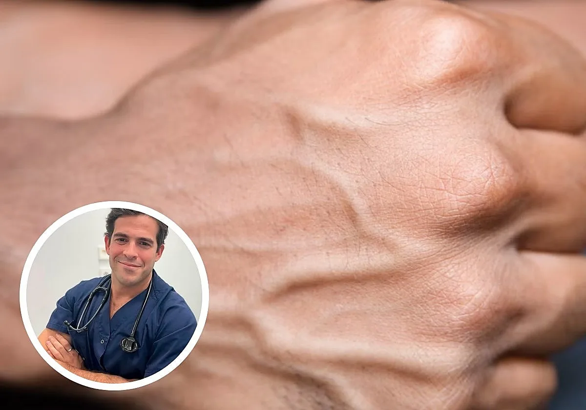 Aurelio Rojas, cardiólogo: «Si se te ven muchísimo las venas de las manos o los pies no significa que tengas mala circulación ni que tu sangre sea más espesa»