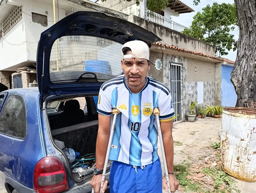 Ronielt Fajardo perdió su pierna derecha por los terremotos y no deja se sonreír: «Volví a nacer el 24 de junio»