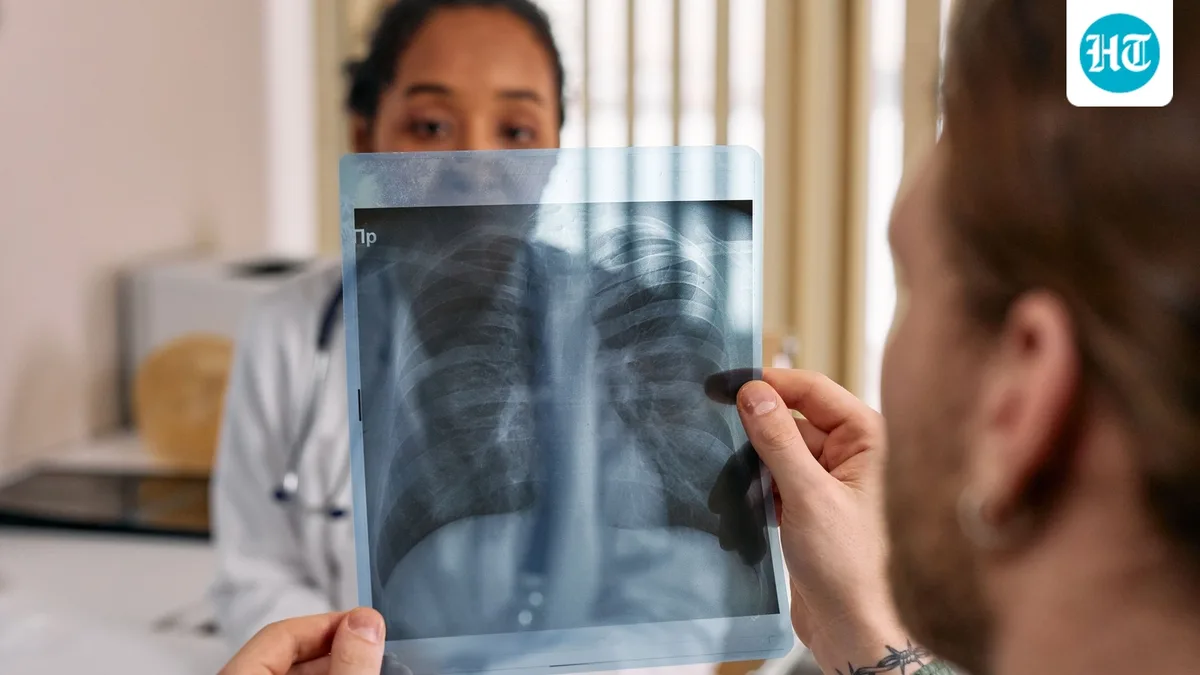 Pulmonologist Dr Harish Verma shares 5 lung cancer symptoms people mistake for lifestyle issues