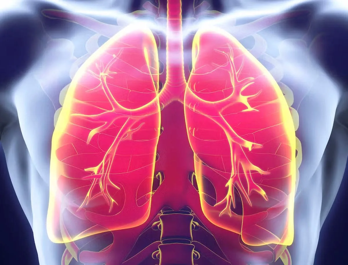 Lo detectaron a tiempo en el Papa: en la Argentina, el cáncer de pulmón sigue siendo el que más mata
