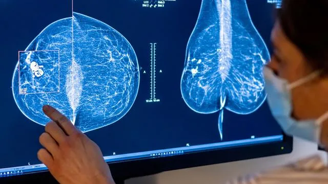 Gesundheit: Hamburgisches Krebsregister wird 100 Jahre alt