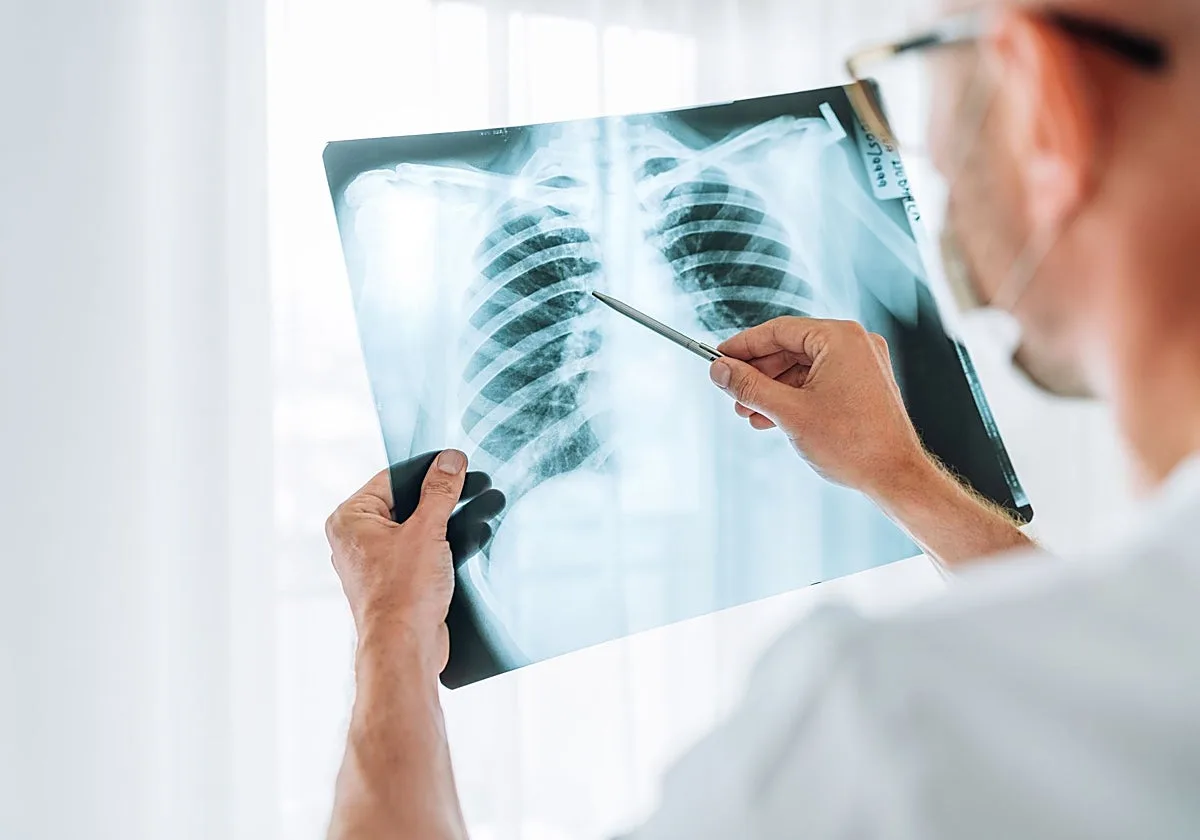 Conocemos el nombre del cáncer del Papa, pero faltan los apellidos: «Un tumor pequeño también puede ser agresivo»