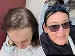 When Gwen started losing her hair at 40, she felt like she'd lost her identity. None of the miracle solutions helped... then she discovered a method that restored her locks - and confidence