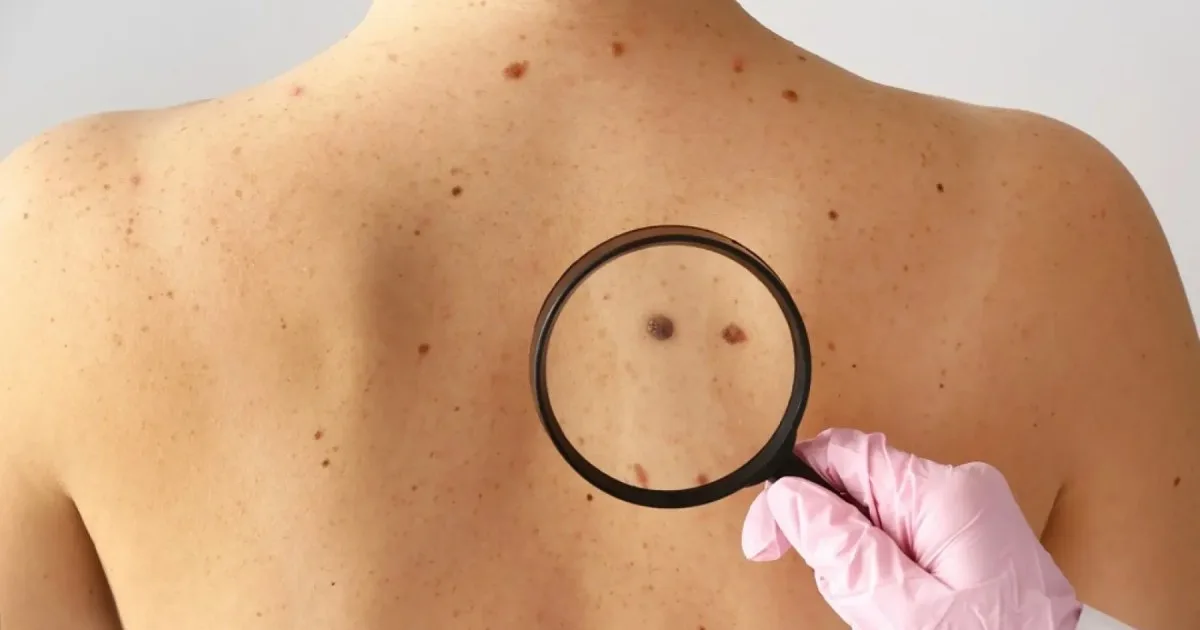 Hito en la medicina: la primera vacuna de ARN contra el cáncer supera con éxito la fase final