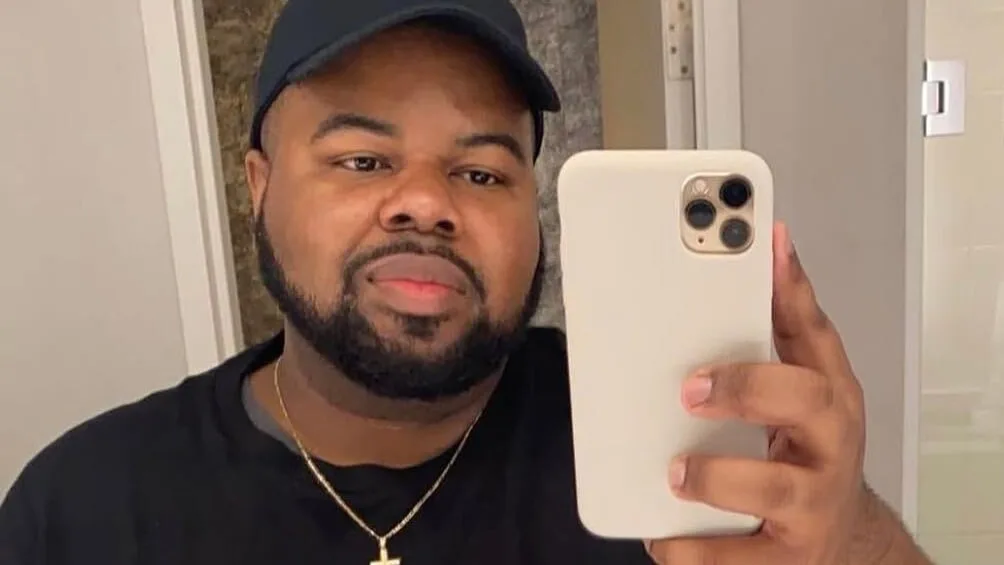 Reality Star Reveals Dramatic Hair Transplant and Weight Loss Makeover