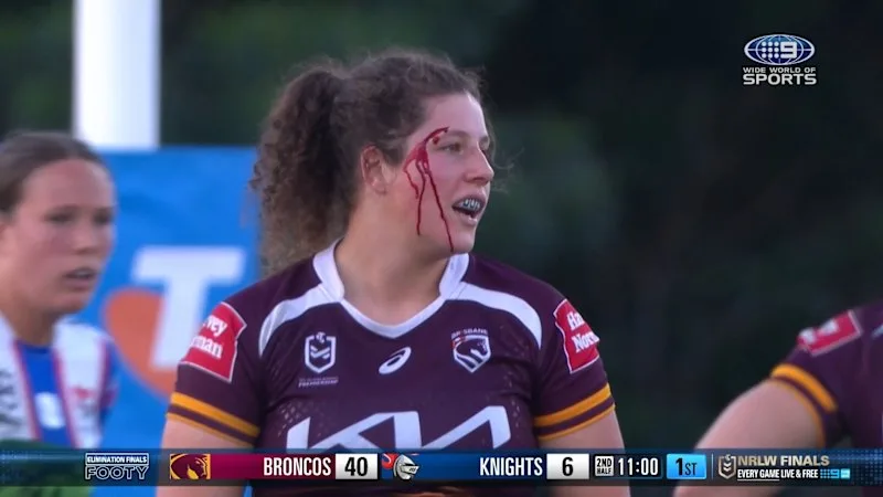 Broncos duo in brutal head clash