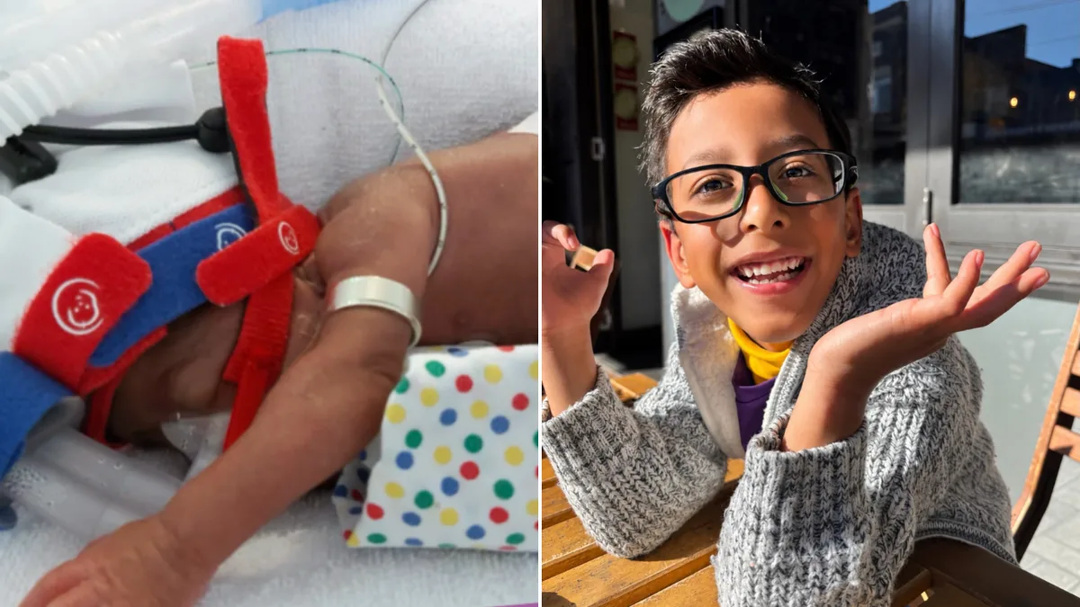Benji was born at 25 weeks and weighing 550g. Today the micropreemie is about to finish kindy.