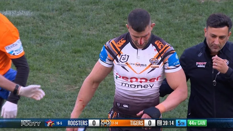 Twal cut open, throws mouthguard in fury