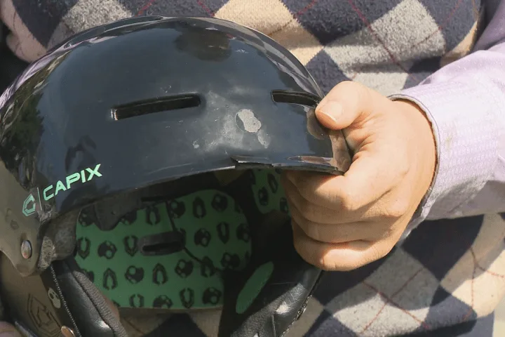 ‘Put on the damn helmet’: Vancouver comedian urges safety following e-scooter collision