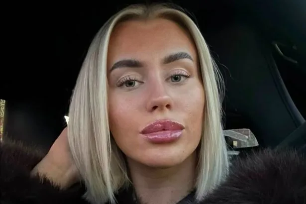 Sunbed addict diagnosed with cancer at 22 after insisting doctors remove mole