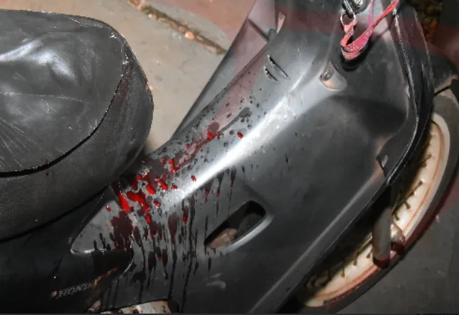 Baleado no pescoço, motociclista pede ajuda em hospital e é intubado
