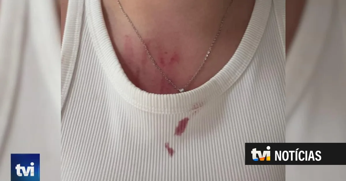 Funcionárias de casa de acolhimento em São Miguel repetidamente agredidas por duas jovens com problemas psiquiátricos