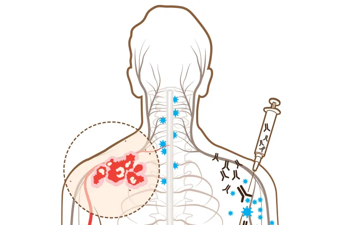 Vacina do herpes-zóster vai chegar ao SUS? Entenda Projeto de Lei